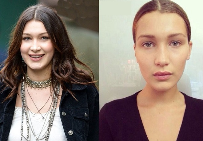 Bella Hadid Before and After Plastic Surgery: boobs, nose, lips