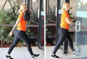 Iggy Azalea Before and After Plastic Surgery: Nose Job, Breast Implants