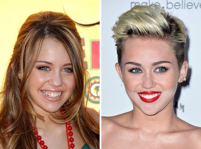 Miley Cyrus Before and After Plastic Surgery: Face, Nose, Teeth, Breast