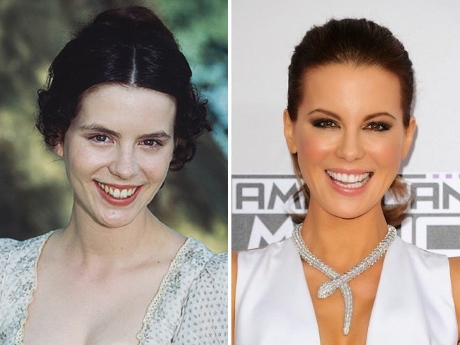 Kate Beckinsale Before and After Plastic Surgery: face, nose, breast