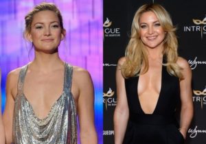 Kate Hudson Before and After Plastic Surgery: Boob, Nose, Teeth