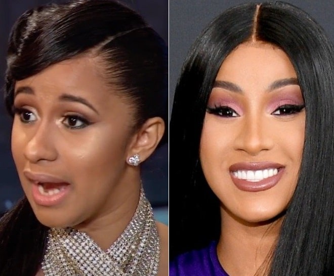 Cardi B Before And After Plastic Surgery Boobs Teeth Nose | My XXX Hot Girl