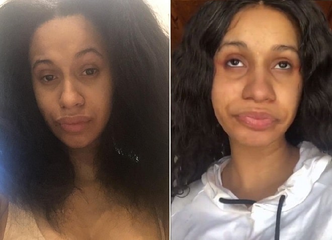 Cardi B Before And After Plastic Surgery: Boobs, Teeth, Nose