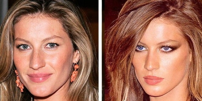 Has Gisele Bundchen Had Plastic Surgery? Transformation Photos