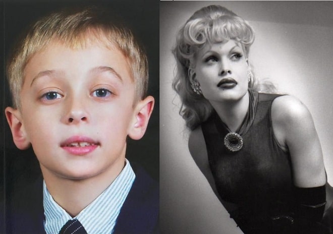 Amanda Lepore Before And After Plastic Surgery Face Body