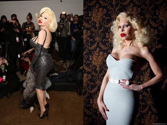 Amanda Lepore Before And After Plastic Surgery Face Body 