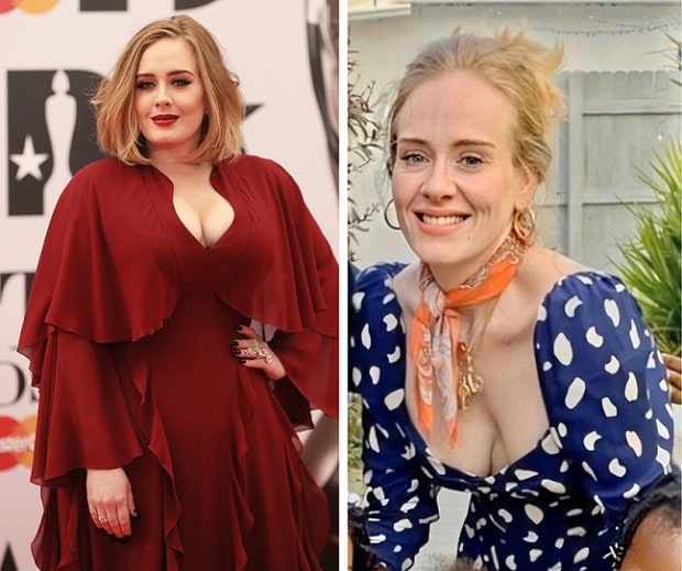 Adele Before and After Weight Loss and Plastic Surgery