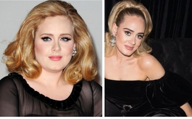 Adele Before and After Weight Loss and Plastic Surgery