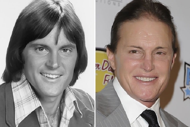 Bruce Jenner Before and After Transformation into Caitlyn Jenner