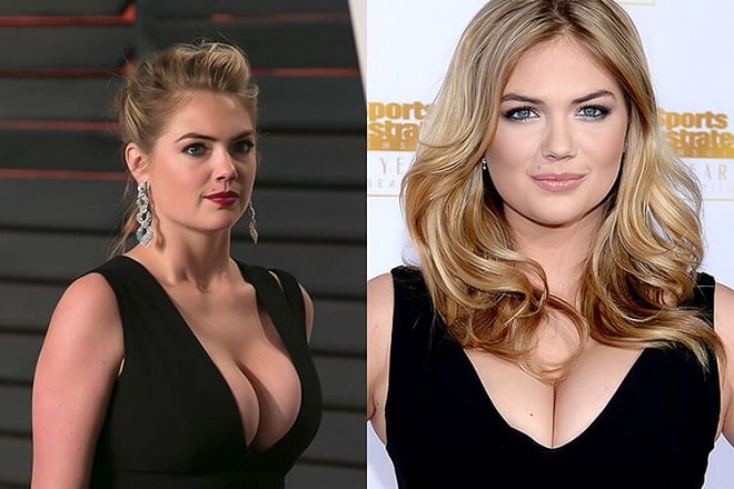 Kate Upton Breast Implants