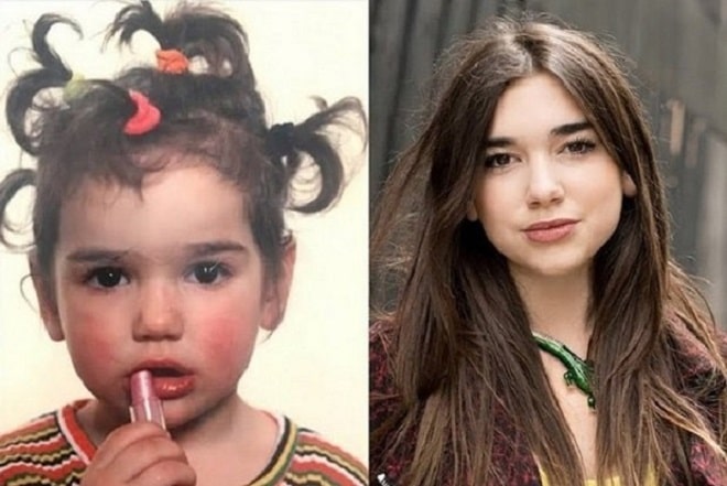 Dua Lipa Before and After Plastic Surgery: Nose, Lips, Face