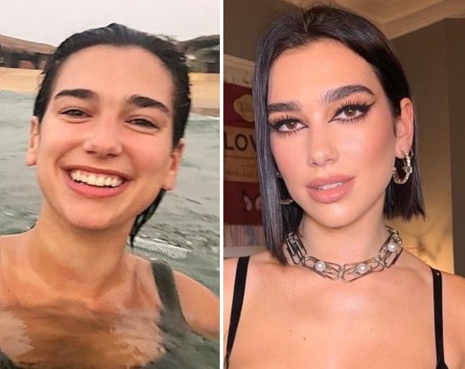 Dua Lipa Before and After Plastic Surgery: Nose, Lips, Face