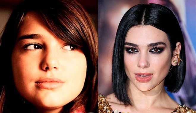 Dua Lipa Before and After Plastic Surgery: Nose, Lips, Face