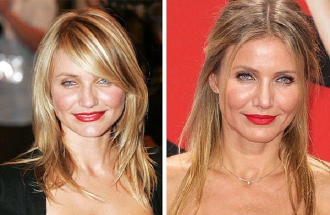 cameron diaz plastic surgery before and after