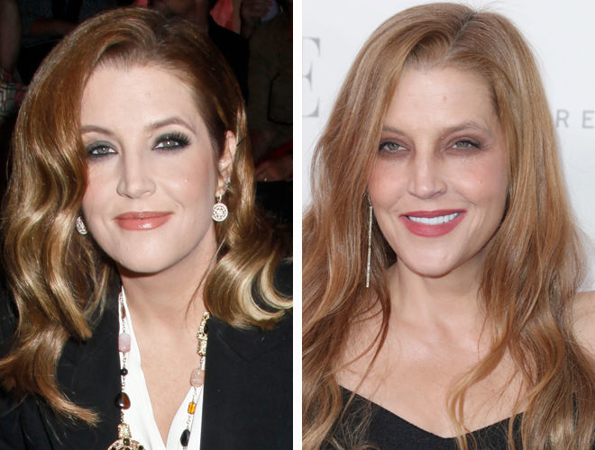 Lisa Marie Presley Before And After Plastic Surgery