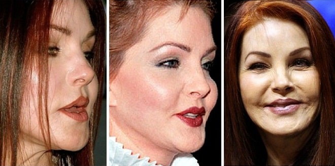 Priscilla Presley Before And After Plastic Surgery In Her Youth And Now