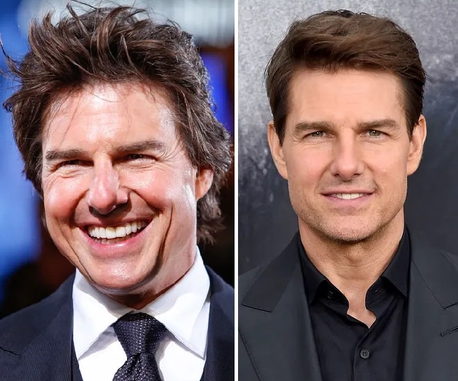 Tom Cruise Before and After Plastic Surgery Face, Nose, Teeth