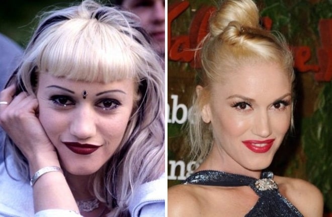 Gwen Stefani Before and After Plastic Surgery: Boob, Nose, Face