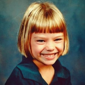 Margot Robbie Before and After Plastic Surgery