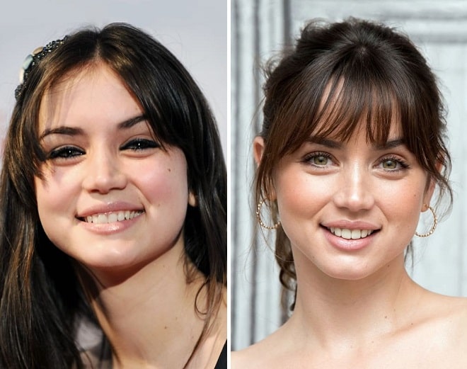 Ana de Armas Before and After Plastic Surgery: Nose, Boob