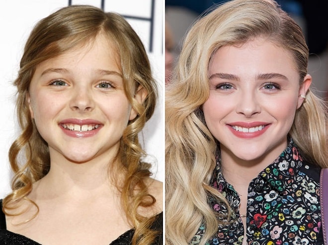 chloemoretz #american #face