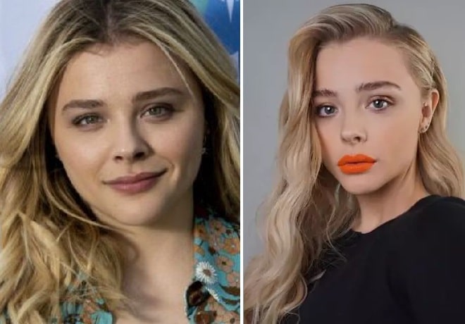 Chloë Grace Moretz Plastic Surgery Speculation Nose Job & Lip Fillers