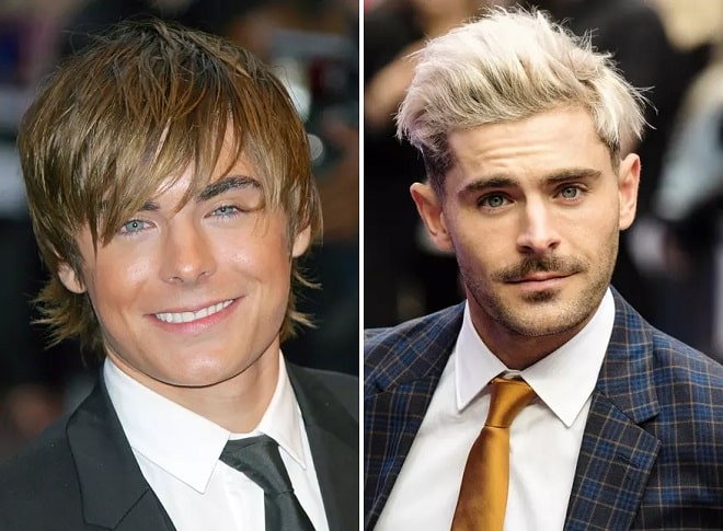 Zac Efron Before and After Plastic Surgery