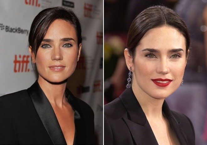 Jennifer Connelly Breast Surgery - Clinic Mono