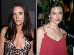 Jennifer Connelly Before and After Plastic Surgery