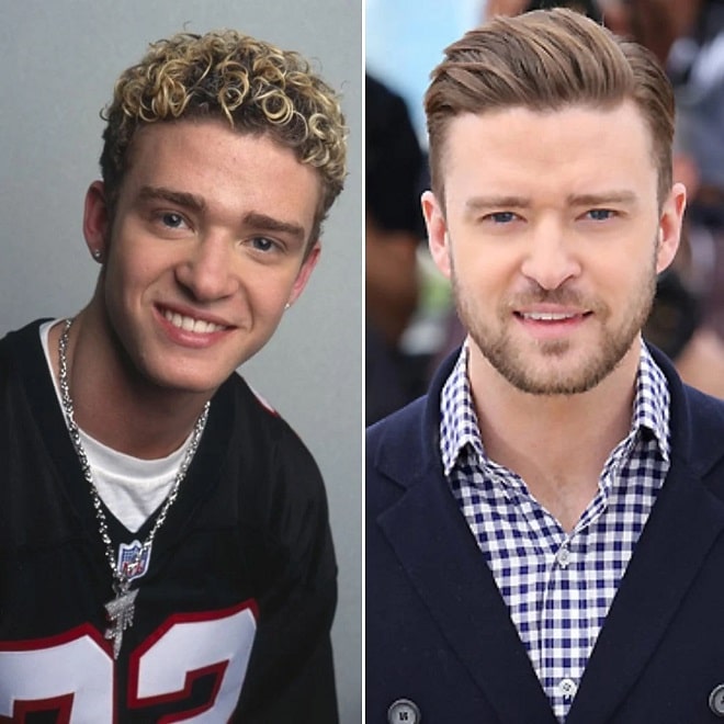 Justin Timberlake Before and After Plastic Surgery