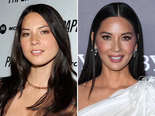 Olivia Munn Before and After Plastic Surgery