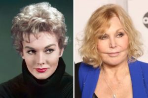 Kim Novak Before and After Plastic Surgery