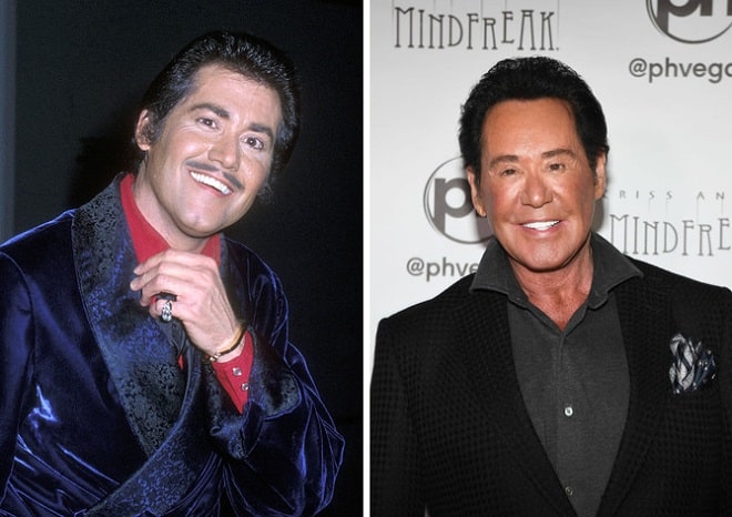 Wayne Newton Before and After Plastic Surgery