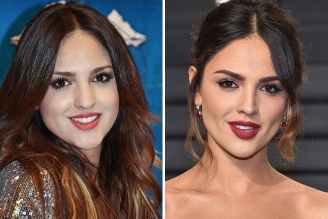 Eiza Gonzalez Before And After Plastic Surgery