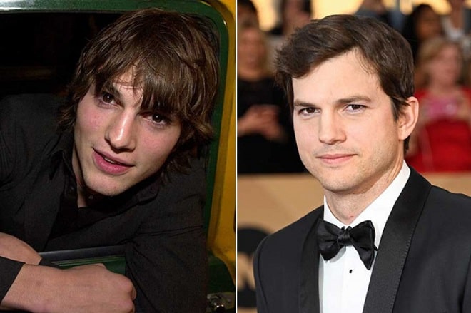 Ashton Kutcher Before and After Plastic Surgery: Nose, Hair