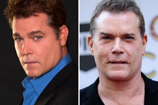 Ray Liotta Plastic Surgery