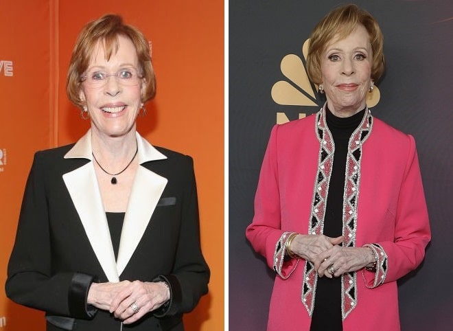 Carol Burnett Before And After Plastic Surgery 2128