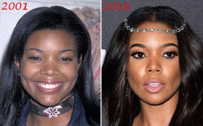 Gabrielle Union Before and After Plastic Surgery: Nose Job