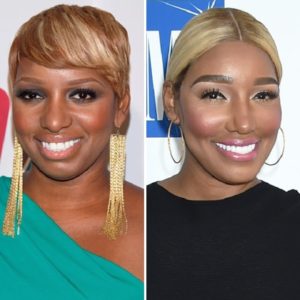 NeNe Leakes Before and After Plastic Surgery: Boob, Nose, Face