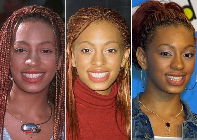 Solange Knowles Before And After Plastic Surgery Nose Face 