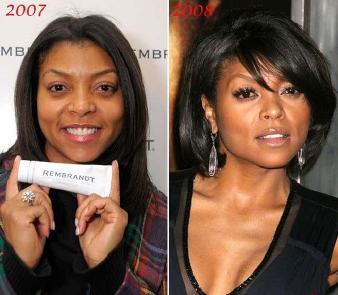 Taraji Henson Before And After Plastic Surgery Boob Nose Face 