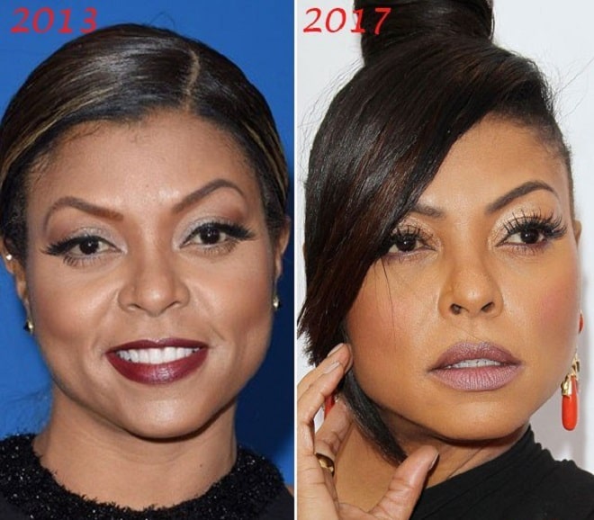 Taraji Henson Before And After Plastic Surgery Boob Nose Face 