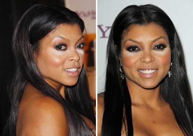 Taraji Henson Before And After Plastic Surgery Boob Nose Face 