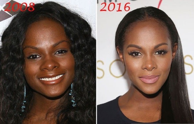 Tika Sumpter Before and After Plastic Surgery: Nose, Face