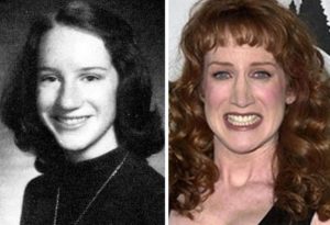 Kathy Griffin Before and After Plastic Surgery: Boob, Nose, Facelift, Botox