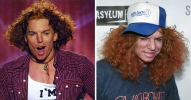 Scott Thompson «Carrot Top» Before and After Plastic Surgery: Facelift