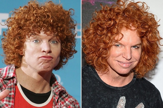 Scott Thompson Carrot Top Before And After Plastic Surgery Facelift Scott Thompson Carrot Top Before And After Plastic Surgery Facelift