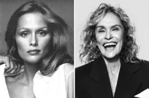 Saran Hutton Lauren Hutton Before and After Plastic Surgery: Teeth, Face, Body